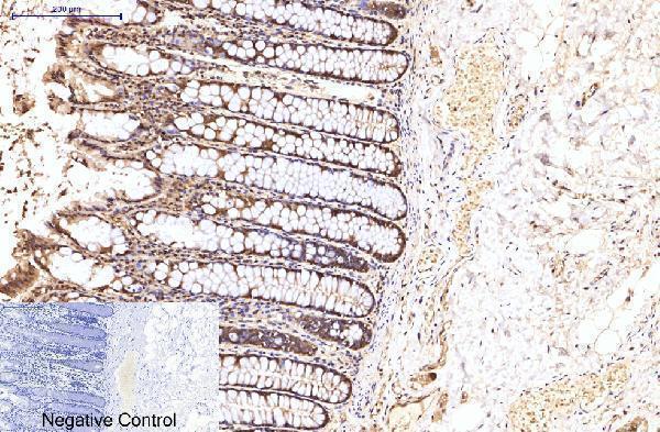 m03922 eif4a1 primary antibodyes ihc testing 2