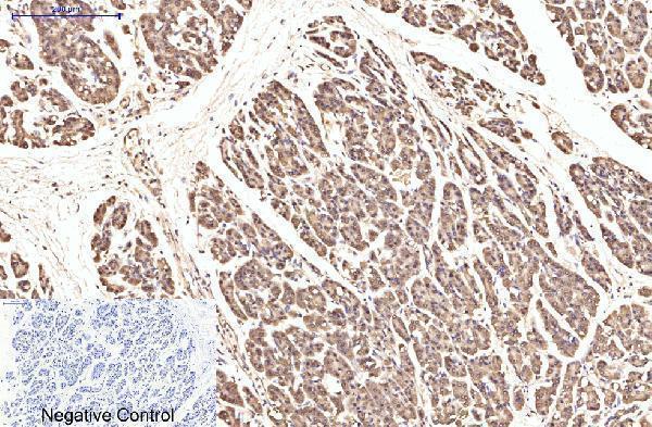 m03922 eif4a1 primary antibodyes ihc testing 5
