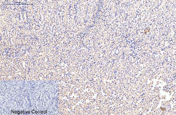 m03922 eif4a1 primary antibodyes ihc testing 8
