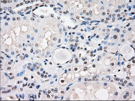 m03927 anti fra1 fosl1 mouse monoclonal antibody clone id oti12f9 ihc testing 10