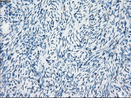 Immunohistochemical staining of paraffin-embedded Ovary tissue within the normal limits using anti-FOSL1mouse monoclonal antibody