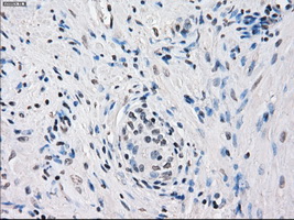 m03927 anti fra1 fosl1 mouse monoclonal antibody clone id oti12f9 ihc testing 5