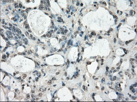 m03927 anti fra1 fosl1 mouse monoclonal antibody clone id oti12f9 ihc testing 9