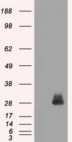 HEK293T cells were transfected with the pCMV6-ENTRY control (Left lane) or pCMV6-ENTRY FOSL1 (Right lane) cDNA for 48 hrs and lysed