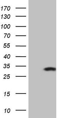 HEK293T cells were transfected with the pCMV6-ENTRY control (Left lane) or pCMV6-ENTRY KCNIP2 (Right lane) cDNA for 48 hrs and lysed