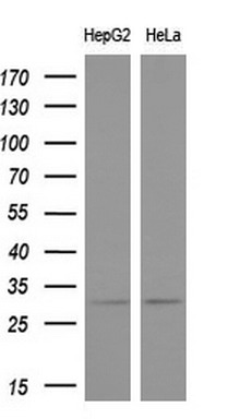 Western blot analysis of extracts (10ug) from 2 different cell lines by using anti-KCNIP2 monoclonal antibody (1:200)