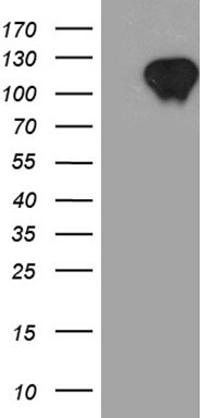 HEK293T cells were transfected with the pCMV6-ENTRY control (Left lane) or pCMV6-ENTRY ZBTB17 (Right lane) cDNA for 48 hrs and lysed