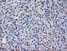 Immunohistochemical staining of paraffin-embedded Human pancreas tissue within the normal limits using anti-MAPK12 mouse monoclonal antibody