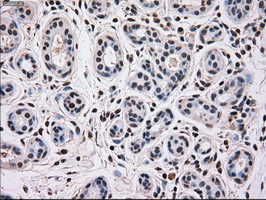Immunohistochemical staining of paraffin-embedded Human breast tissue within the normal limits using anti-MAPK12 mouse monoclonal antibody