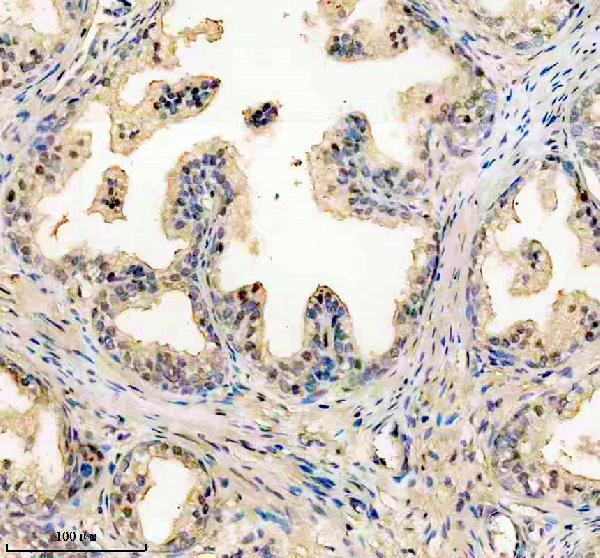 IHC analysis of SYNCRIP using anti-SYNCRIP antibody (M03946-1)