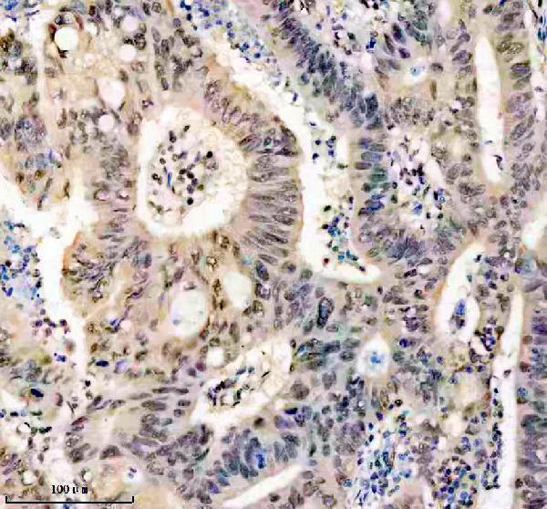 IHC analysis of SYNCRIP using anti-SYNCRIP antibody (M03946-1)