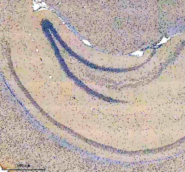 m03946 1 syncrip primary antibodies ihc testing 4