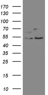 HEK293T cells were transfected with the pCMV6-ENTRY control (Left lane) or pCMV6-ENTRY SS18 (Right lane) cDNA for 48 hrs and lysed