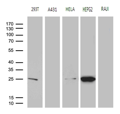 m03948 anti glutathione transferase zeta 1 gstz1 mouse monoclonal antibody clone id oti6a10 wb testing 2