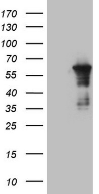 HEK293T cells were transfected with the pCMV6-ENTRY control (Left lane) or pCMV6-ENTRY CEP55 (Right lane) cDNA for 48 hrs and lysed