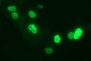 m03959 anti p60 caf1 chaf1b mouse monoclonal antibody clone id oti4f7 if testing 6