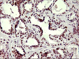 m03959 anti p60 caf1 chaf1b mouse monoclonal antibody clone id oti4f7 ihc testing 3