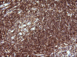 m03959 anti p60 caf1 chaf1b mouse monoclonal antibody clone id oti4f7 ihc testing 4