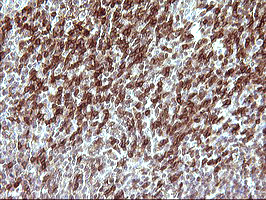 m03959 anti p60 caf1 chaf1b mouse monoclonal antibody clone id oti4f7 ihc testing 5