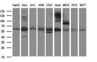 m03959 anti p60 caf1 chaf1b mouse monoclonal antibody clone id oti4f7 wb testing 2