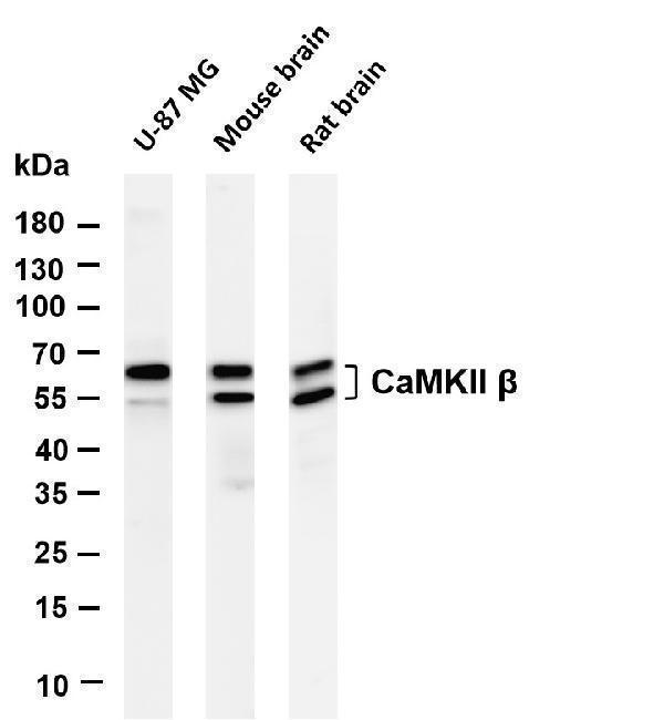 m03964 4 camk2b primary antibodies wb testing 1