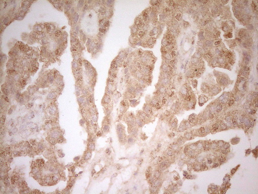 m03967 anti btg1 mouse monoclonal antibody clone id oti7h6 ihc testing 1