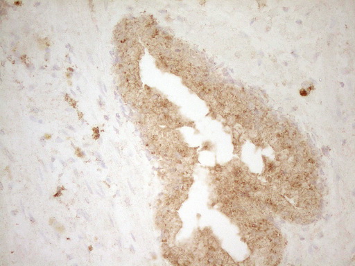 m03967 anti btg1 mouse monoclonal antibody clone id oti7h6 ihc testing 2