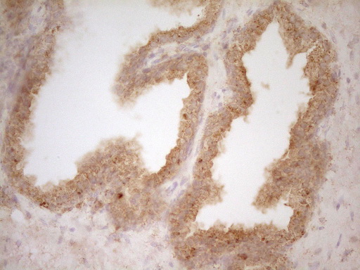 m03967 anti btg1 mouse monoclonal antibody clone id oti7h6 ihc testing 3