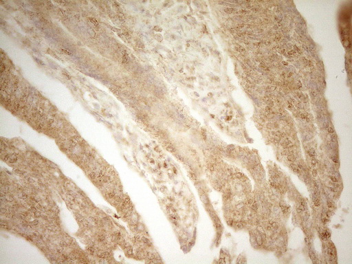 m03967 anti btg1 mouse monoclonal antibody clone id oti7h6 ihc testing 4
