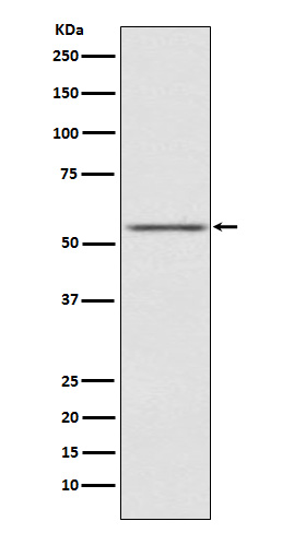 Western blot analysis of AMHR2 expression in SK-OV-3 cell lysate