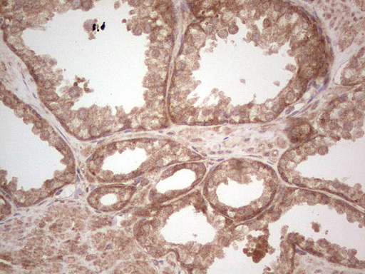 m03971 anti ube2d2 mouse monoclonal antibody clone id oti2c2 ihc testing 10