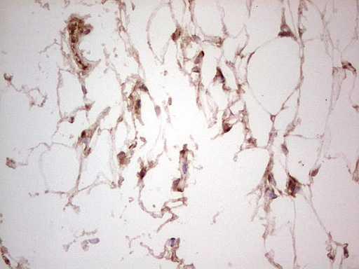 m03971 anti ube2d2 mouse monoclonal antibody clone id oti2c2 ihc testing 11
