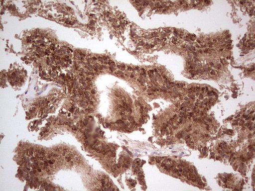 m03971 anti ube2d2 mouse monoclonal antibody clone id oti2c2 ihc testing 12