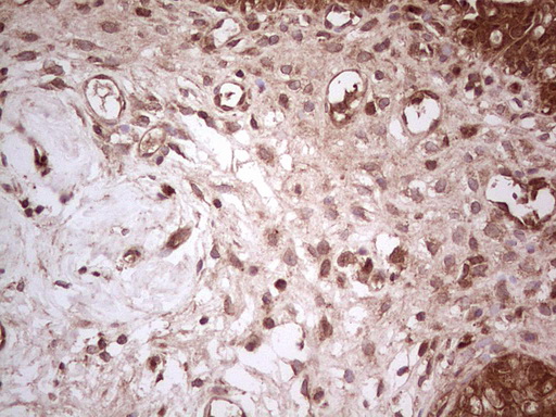 m03971 anti ube2d2 mouse monoclonal antibody clone id oti2c2 ihc testing 14