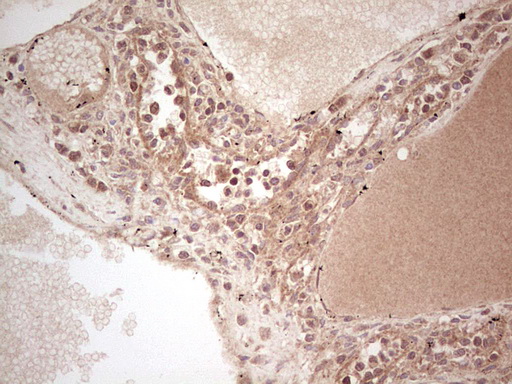 m03971 anti ube2d2 mouse monoclonal antibody clone id oti2c2 ihc testing 15