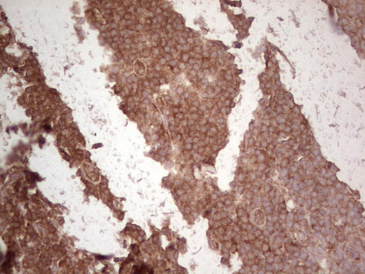 m03971 anti ube2d2 mouse monoclonal antibody clone id oti2c2 ihc testing 17