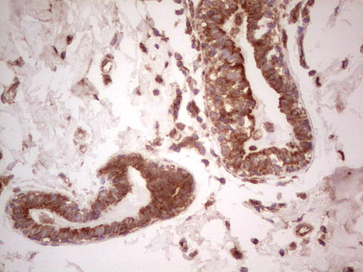 m03971 anti ube2d2 mouse monoclonal antibody clone id oti2c2 ihc testing 18