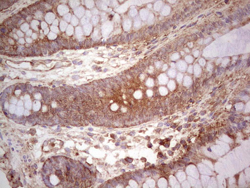 m03971 anti ube2d2 mouse monoclonal antibody clone id oti2c2 ihc testing 19