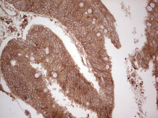 m03971 anti ube2d2 mouse monoclonal antibody clone id oti2c2 ihc testing 20