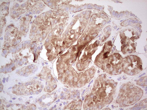 m03971 anti ube2d2 mouse monoclonal antibody clone id oti2c2 ihc testing 21