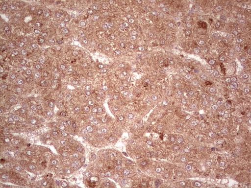 m03971 anti ube2d2 mouse monoclonal antibody clone id oti2c2 ihc testing 23