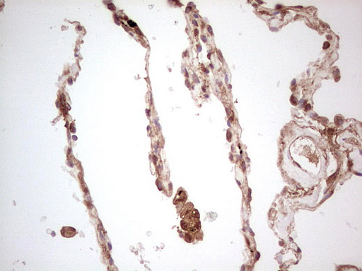 m03971 anti ube2d2 mouse monoclonal antibody clone id oti2c2 ihc testing 24
