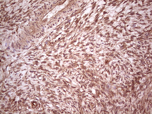 Immunohistochemical staining of paraffin-embedded Human Ovary tissue within the normal limits using anti-UBE2D2 mouse monoclonal antibody