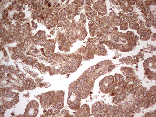 m03971 anti ube2d2 mouse monoclonal antibody clone id oti2c2 ihc testing 4