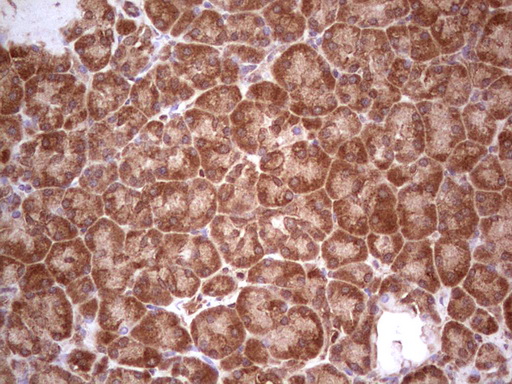 m03971 anti ube2d2 mouse monoclonal antibody clone id oti2c2 ihc testing 5
