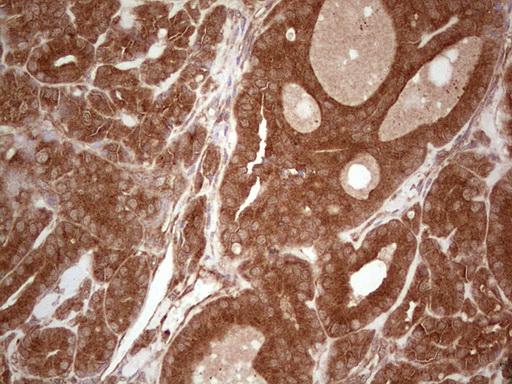 m03971 anti ube2d2 mouse monoclonal antibody clone id oti2c2 ihc testing 7