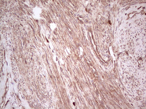 m03971 anti ube2d2 mouse monoclonal antibody clone id oti2c2 ihc testing 9