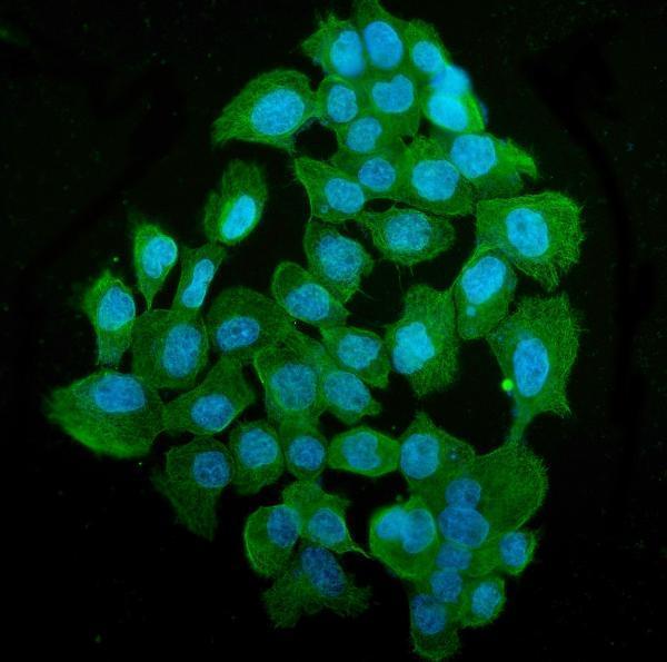 m03989 3 tubulin_alpha primary antibodies if testing 9