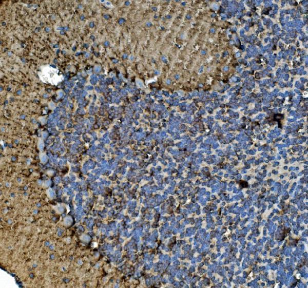 m03989 3 tubulin_alpha primary antibodies ihc testing 2