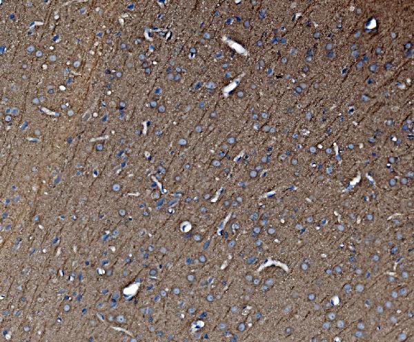 m03989 3 tubulin_alpha primary antibodies ihc testing 3